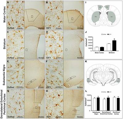 IGF1 Gene Therapy Modifies Microglia in the Striatum of Senile Rats